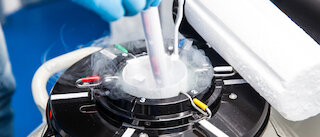 Fertilitätsreserve @ 