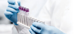 praeimplantationsdiagnostik @ 